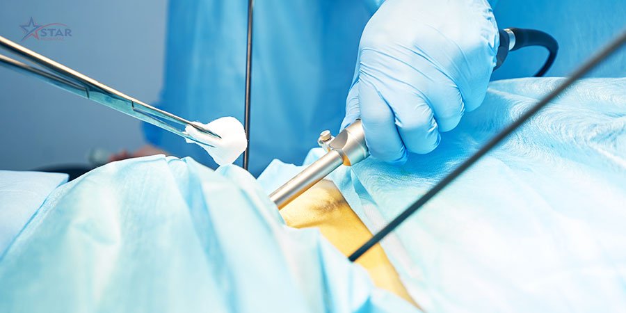 General Surgery at Samridhi Hospital